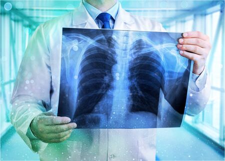 Doctor looking chest x-ray film in hospital.