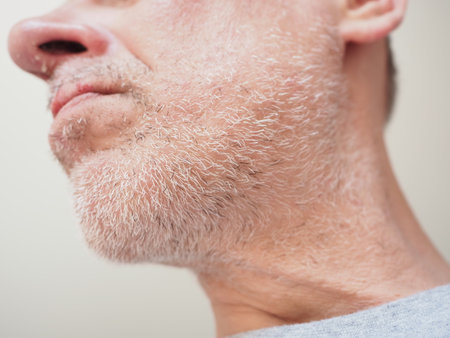 Closeup of a man's face with hair loss problem and beardの写真素材