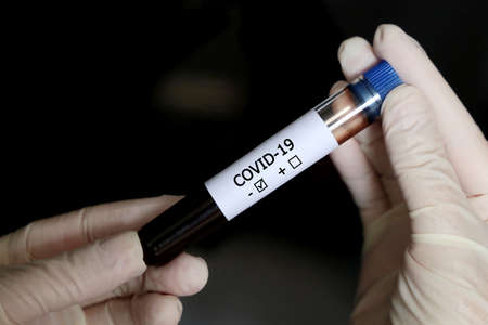Test tube with covid-19 blood sample in female hands close up. Doctor or scientist with negative...