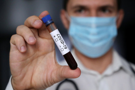 Test tube with covid-19 blood sample in male hand close up. Doctor or scientist with coronavirus...