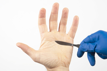 gloved hand with medical scalpel on white backgroundの写真素材