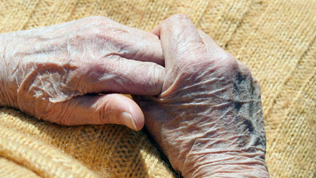 Senior woman massages painful hands outdoorの写真素材