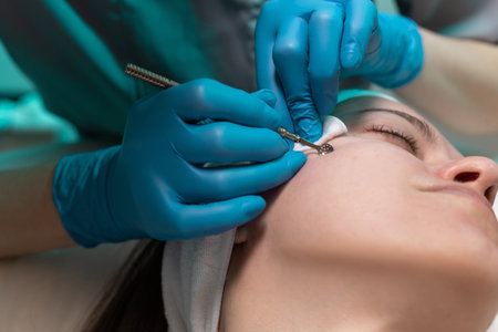 Cosmetologist removes black spots and acne on the womans face skin