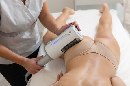 Deep Cellulite Reduction by Endospheres apparatusの写真素材