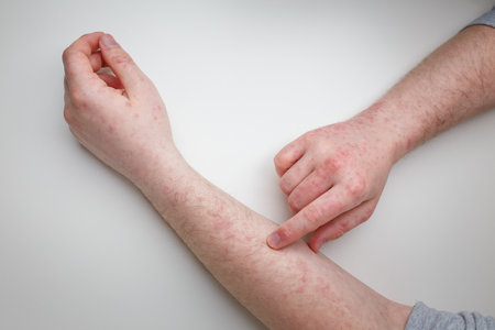 Patient showing red itchy rash on hands and arms. Dermatitis, eczema, dermatological problem, skin treatment and health care. Top viewの写真素材