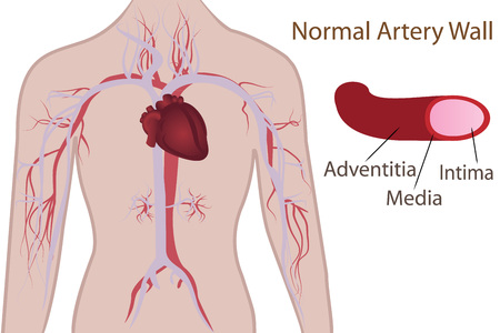 Artery system in human body vector illustrationのイラスト素材