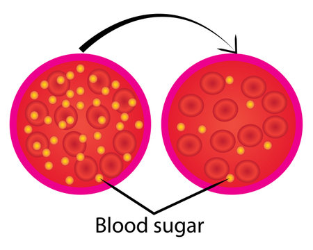 reduce blood sugar level control  medical lab analysis vector illustrationのイラスト素材