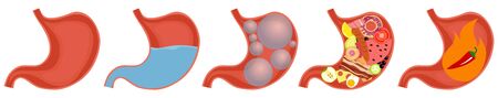 Human Stomach. Empty and full stomach. Bloating. Vector.のイラスト素材