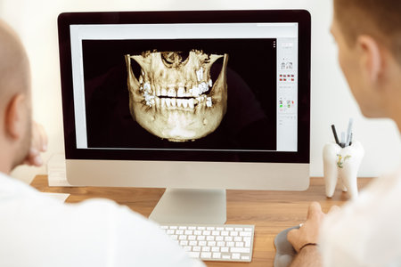 Dentists and assistant discussing the x-ray photograph on computer