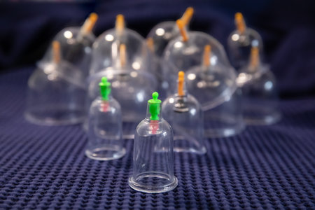 Modern Vacuum Cupping Therapy Cups Set on Dark Blue Fabric
