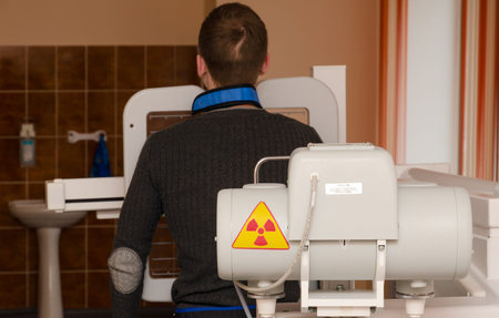 MOGILEV, BELARUS - APRIL 24, 2015: Young man undergoes annual mandatory fluorographic examination on digital X-ray apparatus "Pulmoscan" in X-ray room of polyclinicのeditorial素材