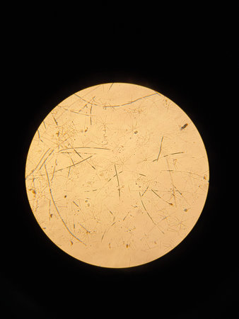 Colony of diatoms Asterionella under the magnification of a light microscope. High quality photo