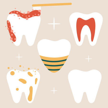 set of elements with clean teeth, stains, toothpaste, implant and toothbrush, flat vector...