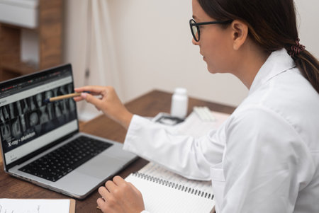 Young doctor in glasses looks at X-ray images pointing with pencil at laptop screen female traumatologist diagnoses patient working with examination results side viewの写真素材