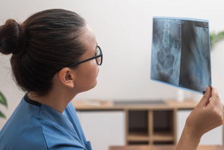 Young doctor examines X-ray image of patient closeup side view woman medic works with examination data sitting in office on blurred background work in modern clinicの写真素材