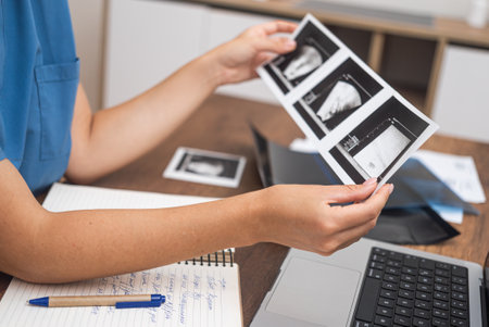 Ultrasound Interpretation: Dressed in blue scrubs, the doctor interprets ultrasound results, making comprehensive notes on her laptop for detailed documentation.の写真素材