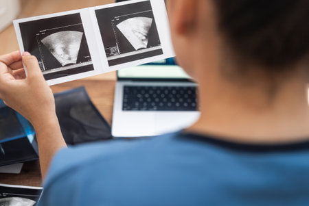 Therapist in blue medical uniform looks at results of ultrasound examination closeup doctor studies information to establish diagnosis and prescribe treatment backside viewの写真素材