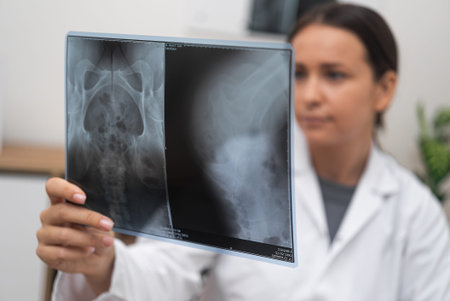 medical healthcare service, worried doctor looks at radiological X-ray film for precise diagnosis of...