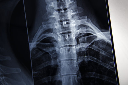 radiograph