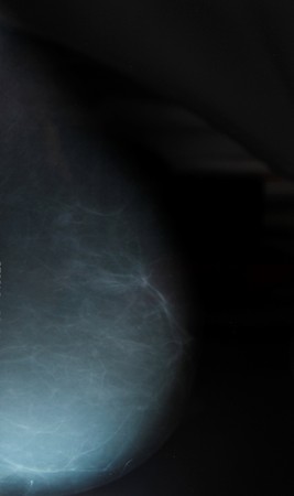 breastsの写真素材