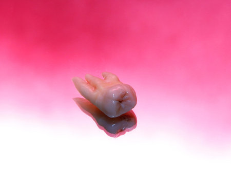 wisdom tooth on the table