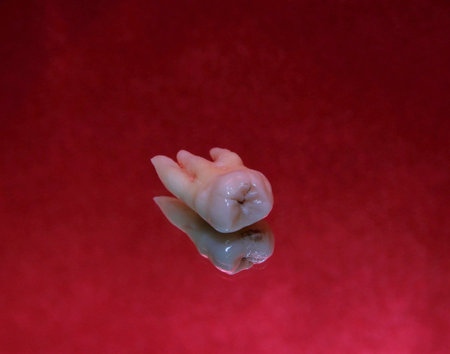 wisdom tooth on the table