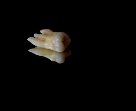 wisdom tooth on the tableの写真素材