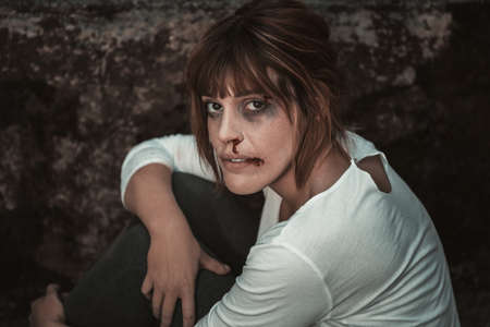 Girl have a bruises under eyesの写真素材