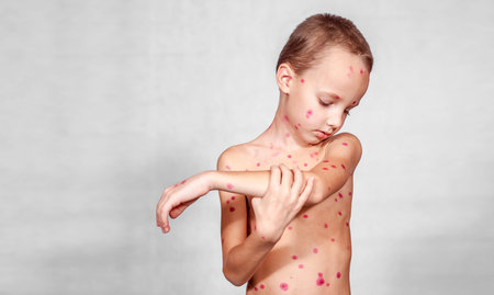 A little cute boy stands on a white background and looks at himself. The concept of chickenpox....