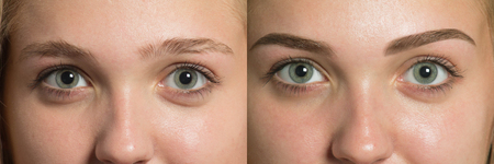 Perfect Eyebrows Before After. Two photos of eyes, eyebrows before & after correction. care and review of the eyes, light brown coloring, natural, perfect shape, procedure. Care, thin out, pull out.の写真素材