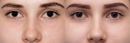Perfect Eyebrows Before After. Two photos of eyes, eyebrows before & after correction. care and review of the eyes, light brown coloring, natural, perfect shape, procedure. Care, thin out, pull out.の写真素材