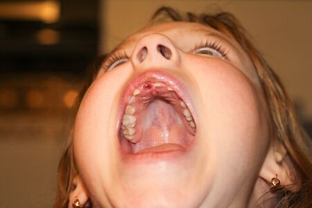 baby's mouth without a toothの写真素材
