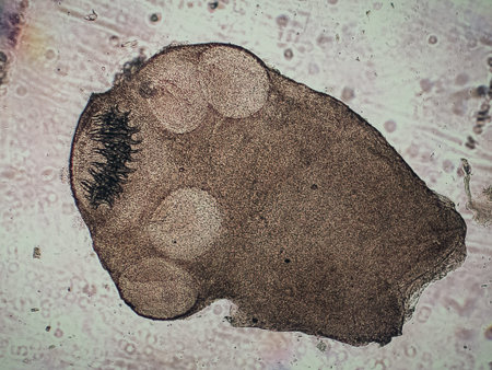 Coenurosis is infection by the metacestode larval stage, - coenurus, - of Taenia multiceps