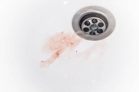gums bleed when brush the teeth and blood in toothpaste foam on white sinkの写真素材