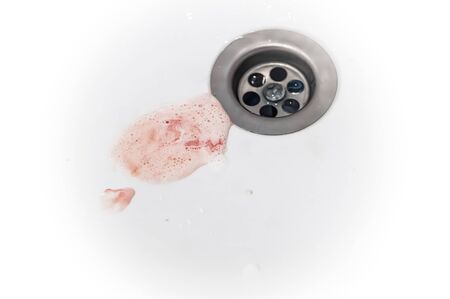 gums bleed when brush the teeth and blood in toothpaste foam on white sinkの写真素材