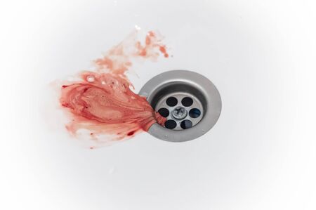 gums bleed when brush the teeth and blood in toothpaste foam on white sinkの写真素材
