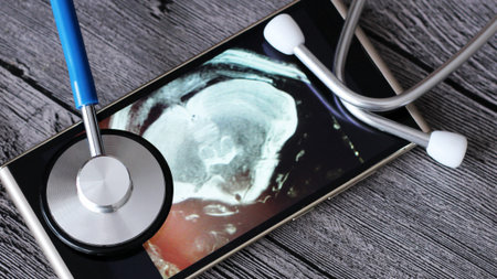 X-ray and stethoscope, medical examination, metal instrument