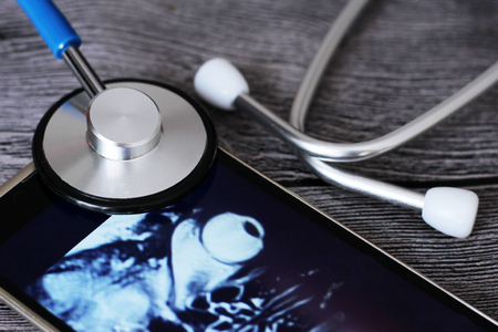 X-ray and stethoscope, medical examination, metal instrumentの写真素材