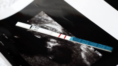 The fetus of a pregnant woman and pregnancy test, health