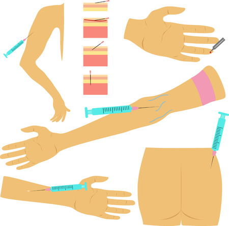 different methods of injection syringeのイラスト素材