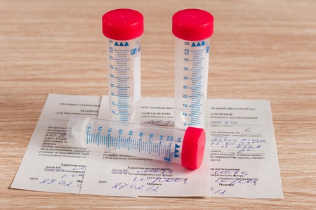 Sterile containers for medical tests