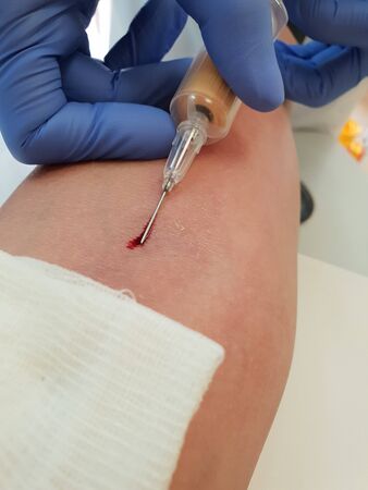 The doctor takes blood from the cubital veinの写真素材