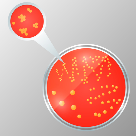 Realistic vector illustration of petri dish with bacteria isolated. Staphylococcus colony on the agar plate.のイラスト素材