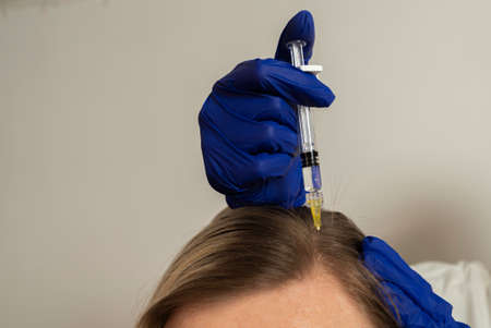 mesotherapy procedure. A cosmetologist does a mesotherapy procedure in a woman's head. Strengthening hair and their growth.の写真素材