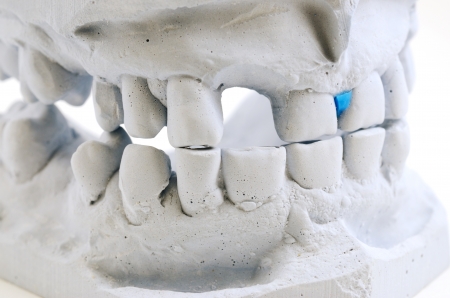 detailed macro of teeth molding over white