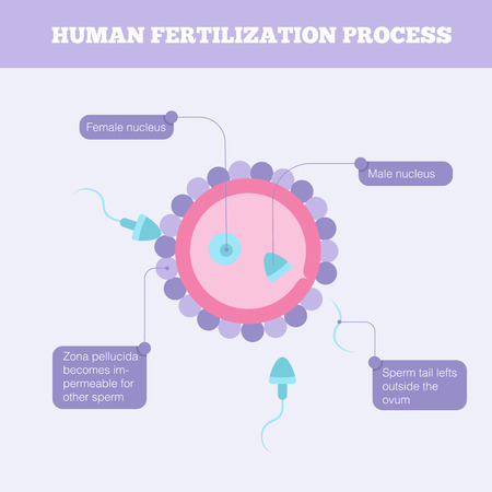 Medical illustration with sperm and ovum. In vitro artificial inseminationのイラスト素材
