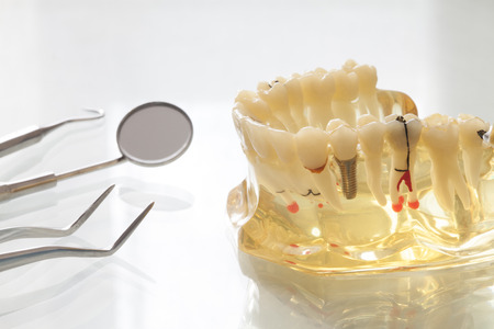 dental equipmentの写真素材