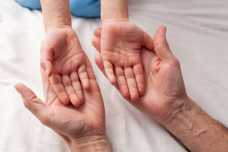 Child shows palms to doctor. Rash or allergic dermatitis. Concept rubella and viral diseases in childrenの写真素材