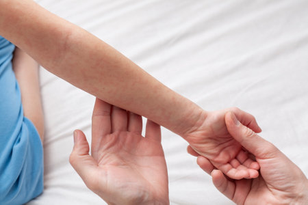 A 7 year old boy shows a rash on his hand to his father. Allergic reactions in childrenの写真素材