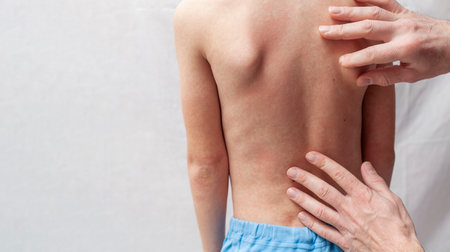 The doctor examines the boy's back. The child has a red rash on his back from an allergy or rubella.の写真素材